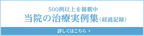 500例以上を掲載中 当院の治療実例集（経過記録） 詳しくはこちら